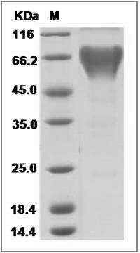 Human EVI2A Protein (Fc Tag) SDS-PAGE