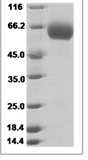 Human TMPRSS11B Protein 15486