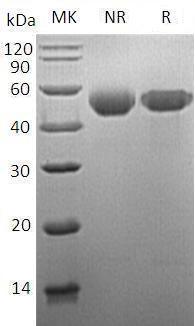 Mouse Serpina1a/Dom1/Spi1-1 (His tag) recombinant protein