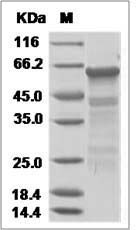 Influenza A H5N6 (A/duck/Guangdong/GD01/2014) Hemagglutinin / HA Protein (His Tag)