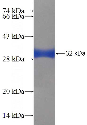 Recombinant Human SS18L2 SDS-PAGE