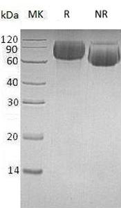 Human LILRB1/ILT2/LIR1/MIR7 (His tag) recombinant protein
