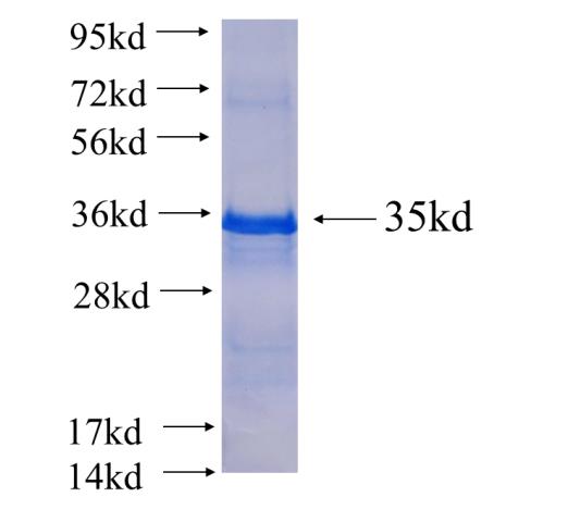 Recombinant human LRRC10 SDS-PAGE