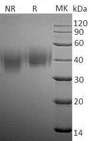 Human SLAMF7/CS1/UNQ576/PRO1138 (His tag) recombinant protein