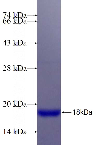 Recombinant Human PXDN SDS-PAGE