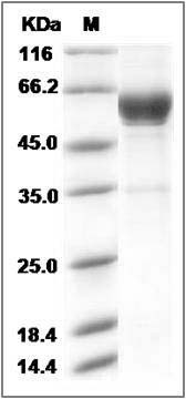 Rat CLEC4A3 Protein (Fc Tag) SDS-PAGE