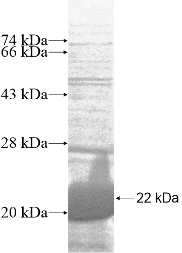 Human CEBPG Recombinant protein (6*His tag)