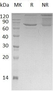 Human XPNPEP1/XPNPEPL/XPNPEPL1 (His tag) recombinant protein