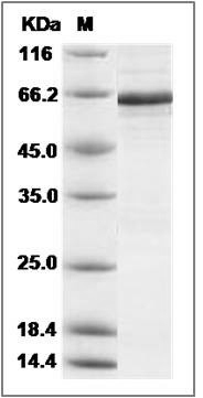Human PDHA1 / C54G1 Protein (aa 30-390, His & GST Tag) SDS-PAGE