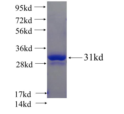Recombinant human CUZD1 SDS-PAGE