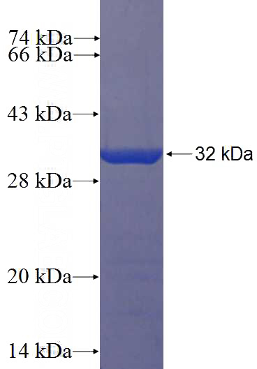 Recombinant Human CCDC33 SDS-PAGE