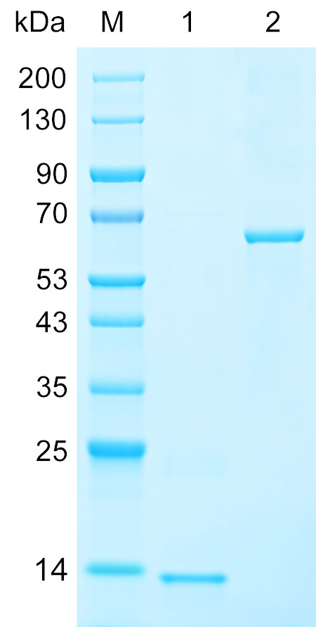 Recombinant AAMDC protein (His tag) SDS-PAGE