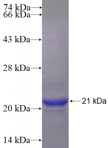 Recombinant Human FAM101B SDS-PAGE