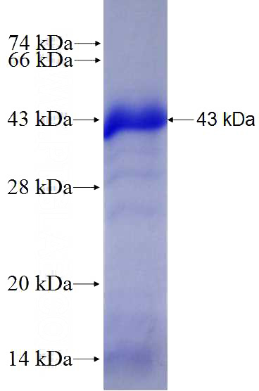 Recombinant Human PKN3 SDS-PAGE
