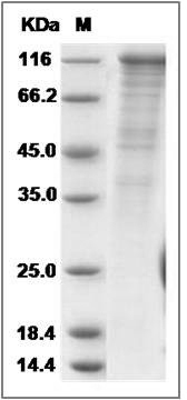 Rat VE-Cadherin / CD144 / CDH5 Protein (Fc Tag) SDS-PAGE