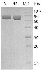 Human EPHA7/EHK3/HEK11 (His tag) recombinant protein