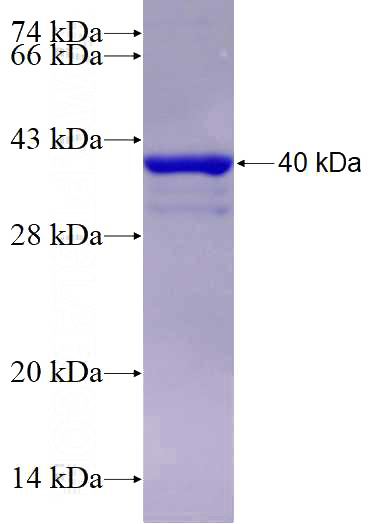 Recombinant Human KDM5B SDS-PAGE