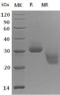 Human KLK4/EMSP1/PRSS17/PSTS (His tag) recombinant protein