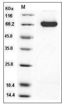 Mouse DLL4 / Delta4 Protein (His Tag) SDS-PAGE