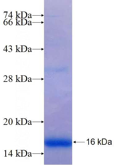 Recombinant Human ZRANB1 SDS-PAGE