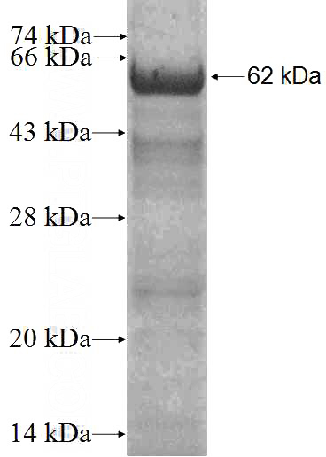 Recombinant Human TRIM37 SDS-PAGE