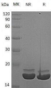 Human RARRES2/TIG2 (His tag) recombinant protein