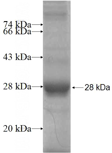 Recombinant Human MBOAT2 SDS-PAGE