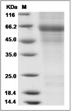 Mouse PROC1 / Protein C / PROC Protein (His Tag) SDS-PAGE