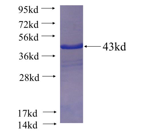 Recombinant human RPL26 SDS-PAGE