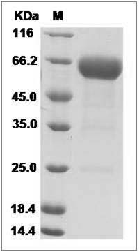 Mouse B7-H5 / GI24 / VISTA Protein (Fc Tag)