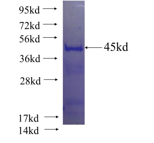 Recombinant human LOC90826 SDS-PAGE