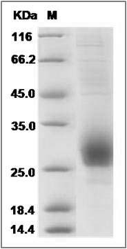 Rat CD79B / B29 Protein (His Tag) SDS-PAGE