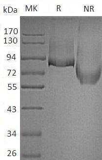 Mouse Thbd (His tag) recombinant protein