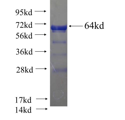Recombinant human CCDC99 SDS-PAGE