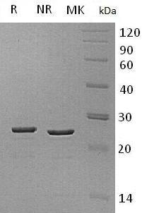 Human HMGB3/HMG2A/HMG4 (His tag) recombinant protein