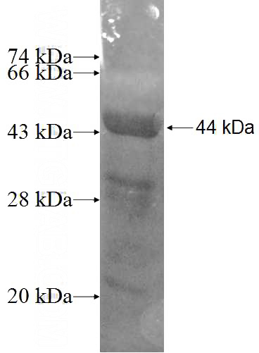 Recombinant Human TBRG4 SDS-PAGE