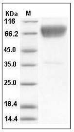 Mouse CD86 / B7-2 Protein (His & Fc Tag) SDS-PAGE