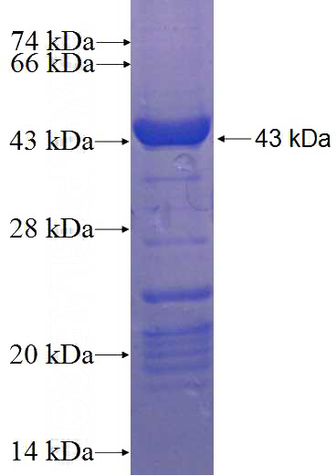 Recombinant Human TCHP SDS-PAGE