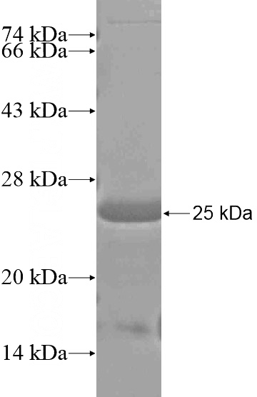 Recombinant Human DMXL1 SDS-PAGE