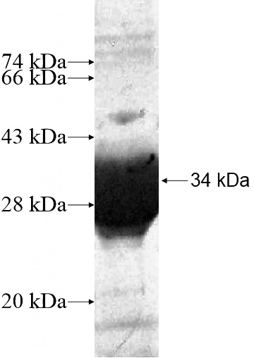 Recombinant Human C10orf116 SDS-PAGE