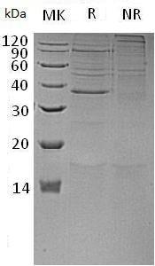 Human HUS1 (His tag) recombinant protein