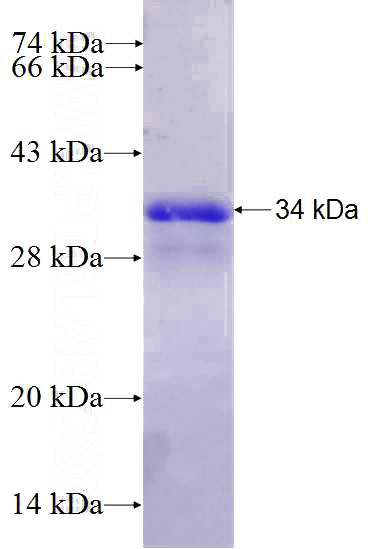 Recombinant Human BRWD2 SDS-PAGE