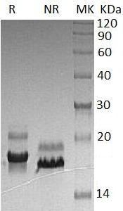 Human TNFRSF10B/DR5/KILLER (His tag) recombinant protein
