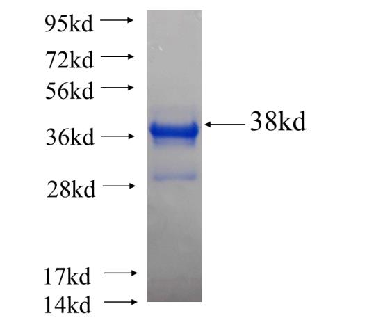 Recombinant human CCDC9 SDS-PAGE