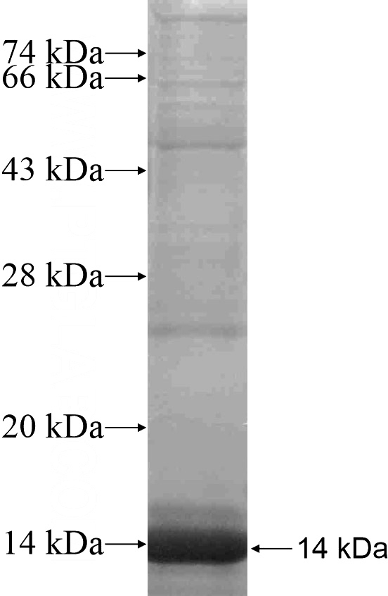 Recombinant Human ENTPD7 SDS-PAGE