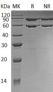 Human COL8A1/C3orf7 (His tag) recombinant protein