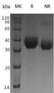 Human DLK1/DLK (His tag) recombinant protein