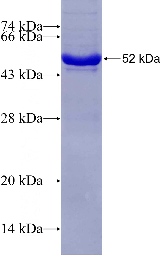 Recombinant Human DNAJC27 SDS-PAGE