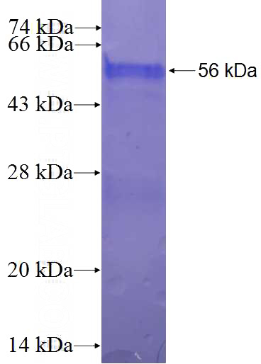 Recombinant Human DUS2L SDS-PAGE