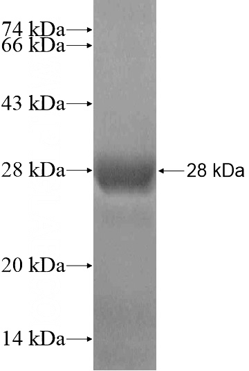 Recombinant Human ANKRD6 SDS-PAGE